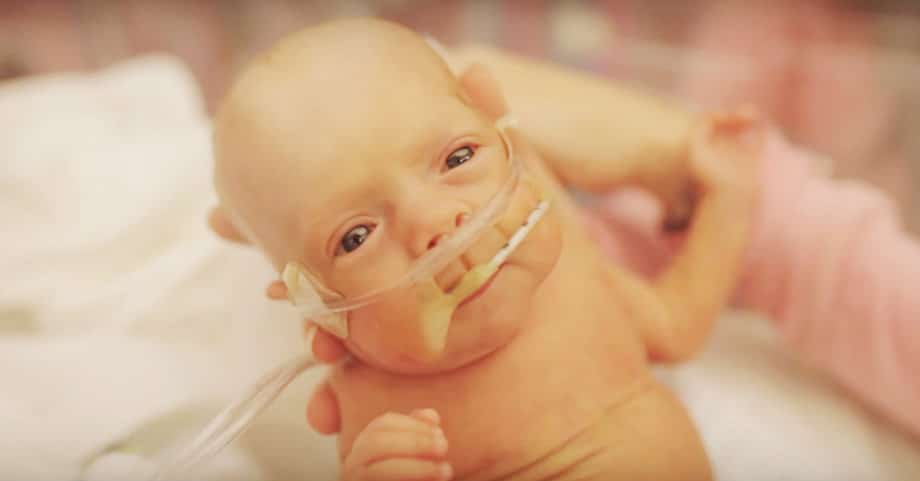 Un Milagro Llamado Ward Miles El Bebe Que Nacio Con Apenas 5 Meses De Gestacion Curiosidades Y Temas Virales